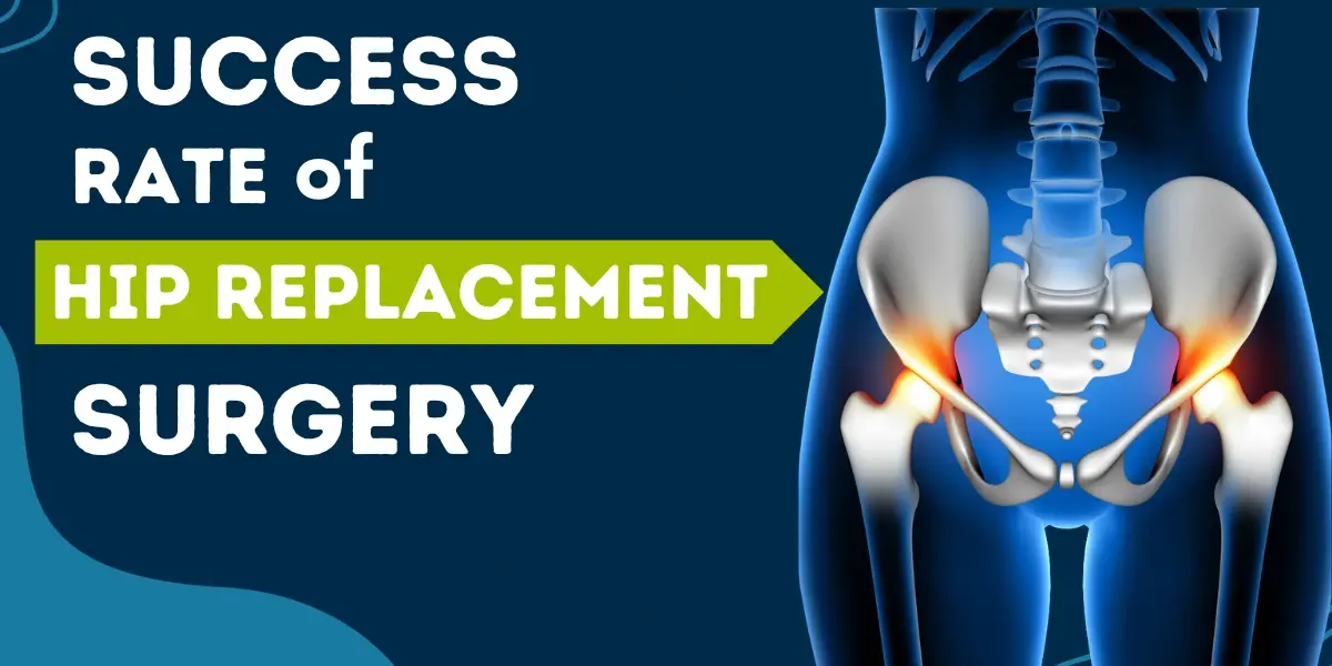 What is the success rate of hip replacement surgery? - DR. MURTAZA